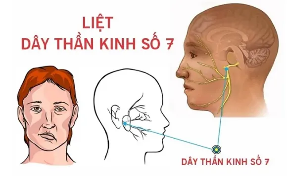 Hỗ Trợ Chăm Sóc Chảy Nước Mắt Sống, Ngứa Mắt, Cộm Mắt Bằng Đông Y